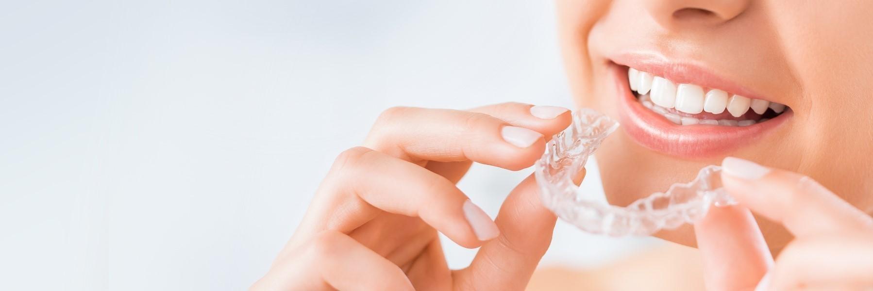 Invisalign Clear Braces | Dentist